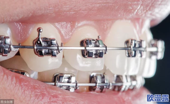 正确口咬的方法图片:详解如何通过科学的方式改善口腔健康与咬合功能的实用指南 正确口咬的方法图片:详解如何通过科学的方式改善口腔健康与咬合功能的实用指南