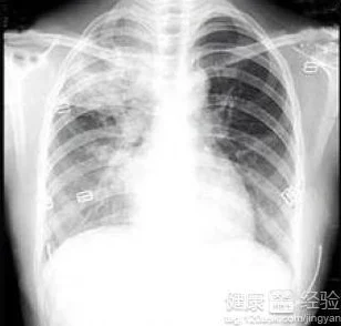 强亲胸揉胸膜下刺激视频在线观看最新进展消息显示该领域的研究正在不断深入,相关技术和应用前景备受关注与期待 强亲胸揉胸膜下刺激视频在线观看最新进展消息显示该领域的研究正在不断深入,相关技术和应用前景备受关注与期待