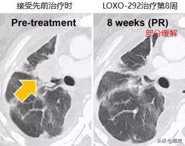 91破解：网友热议其安全性与实用性，是否真的能满足用户需求？你怎么看待这个工具的使用效果？